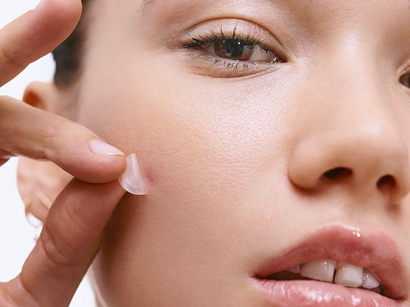 top blemish patch picks
